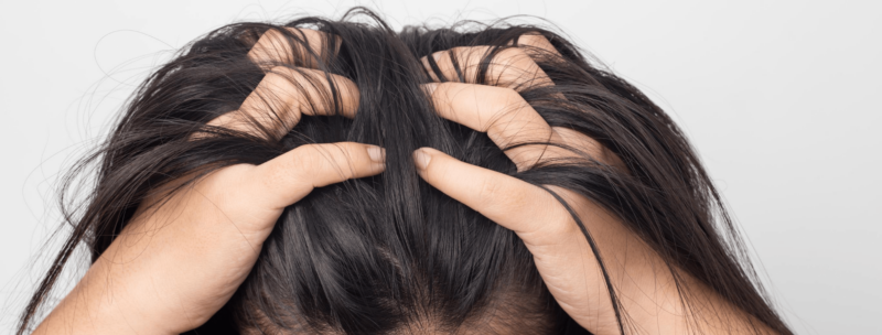 Again, this annoying dandruff and dry and itchy scalp!