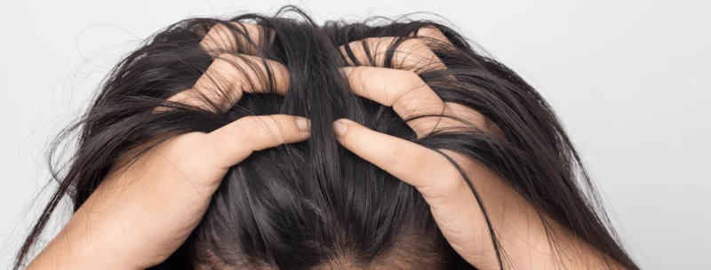 Again, this annoying dandruff and dry and itchy scalp!